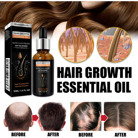 Hair Growth Essential Oil, Dense Hair Growth Repair Dry Hair And Moisture Hair Essence - V.I.P Digital Presence