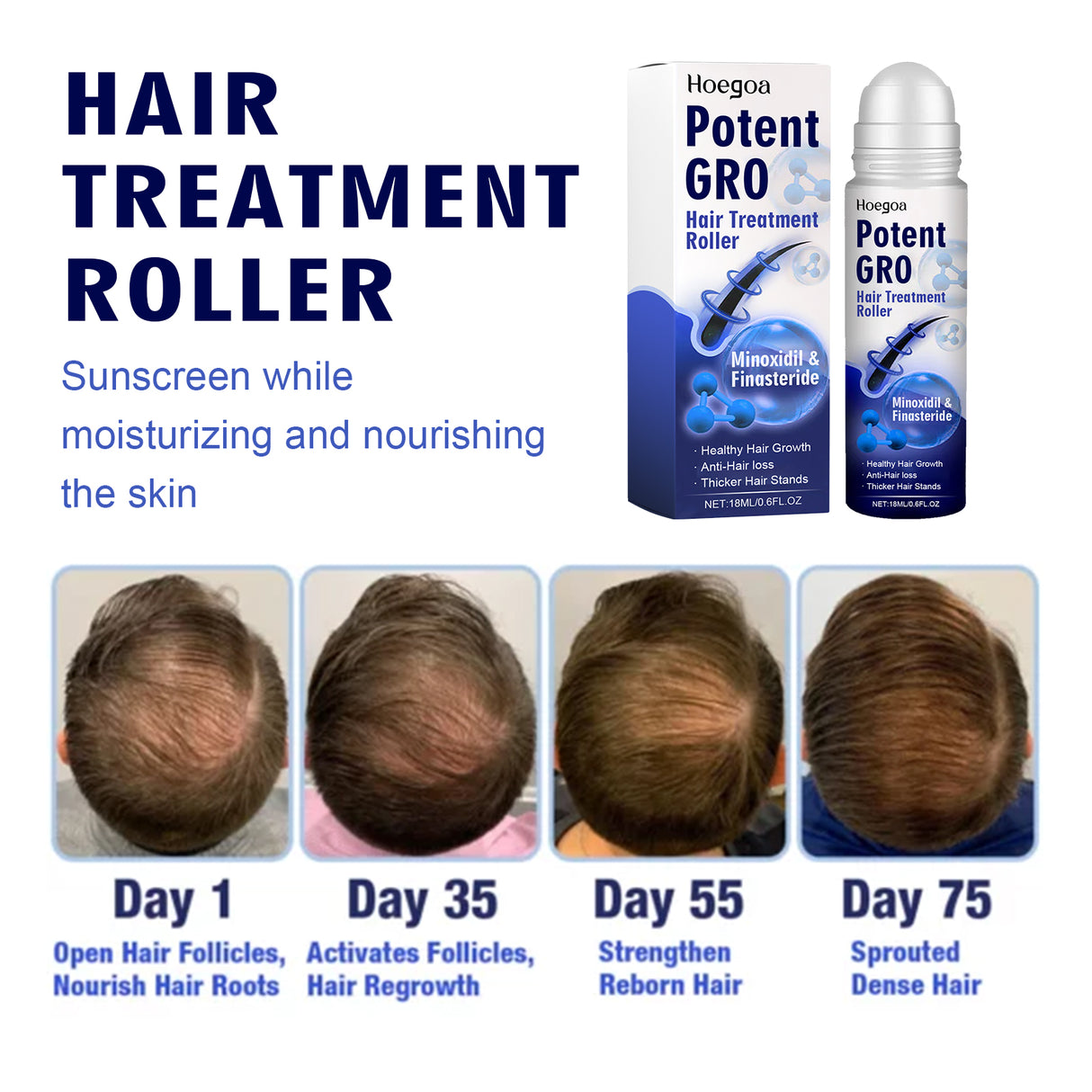 HOEGOA Hair Treatment Roller, Repair Strong And Firm Hair Moistening Hair Roots Thick, Smooth And Dense Hair Care Ball - V.I.P Digital Presence