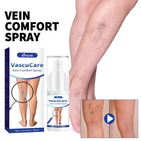 Vein Comfort Spray, Relief Leg Muscle Soreness And Swelling Earthworm Leg Vein Treatment Spray - V.I.P Digital Presence