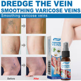Leg Care Spray Gently Relieve Leg Discomfort, Blue Veins And Bumps Repair Daily Care - V.I.P Digital Presence