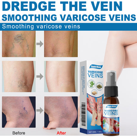 Leg Care Spray Gently Relieve Leg Discomfort, Blue Veins And Bumps Repair Daily Care - V.I.P Digital Presence