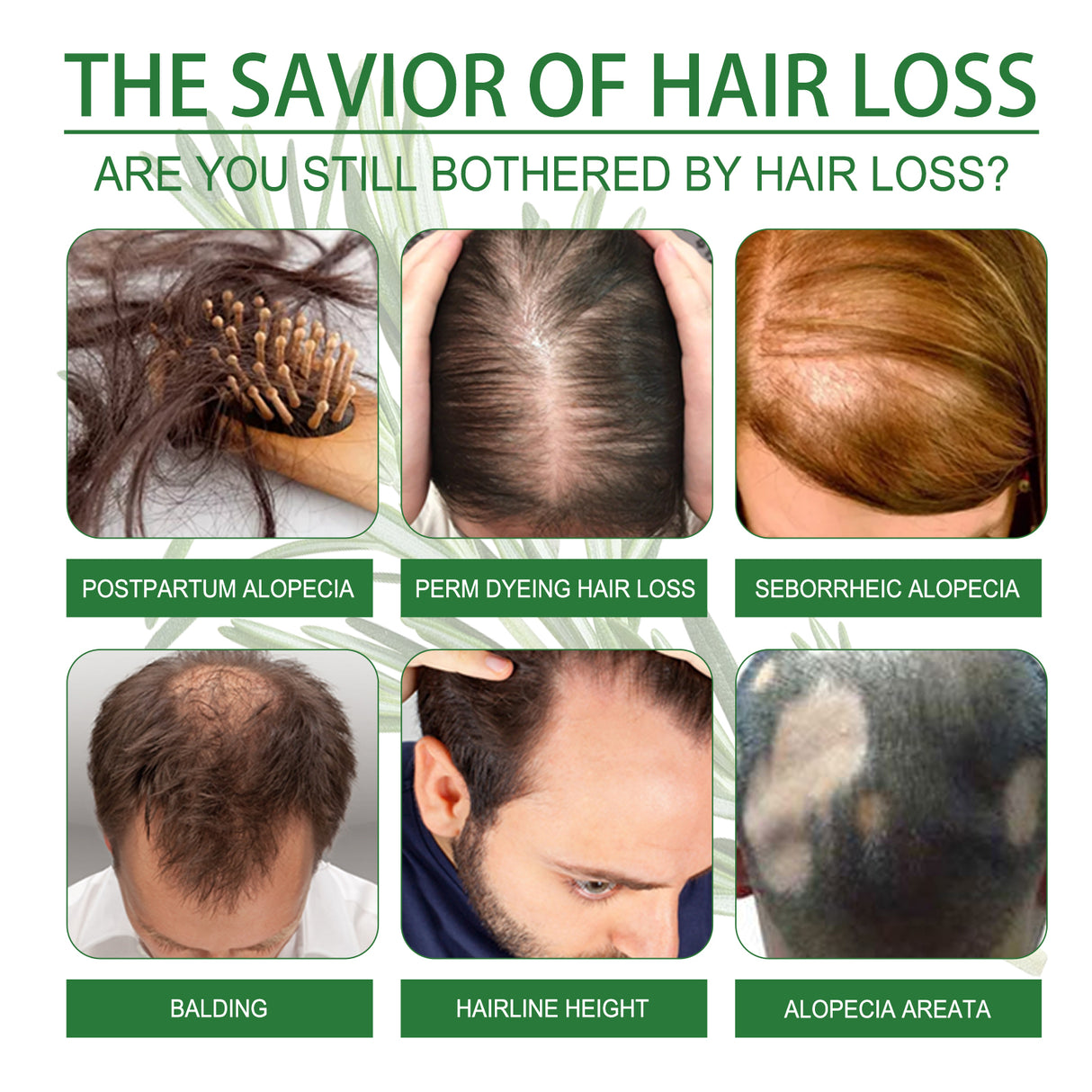 Rosemary Water, Moisturize Hair Roots Repair Damaged Hair Strengthen Hair And Prevent Hair Loss - V.I.P Digital Presence