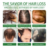 Rosemary Water, Moisturize Hair Roots Repair Damaged Hair Strengthen Hair And Prevent Hair Loss - V.I.P Digital Presence