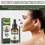 White Spot Purifying Serum For Whitening And Repairing White Spot Spot And Perspiration Spot Skin Moisturizing Serum - V.I.P Digital Presence