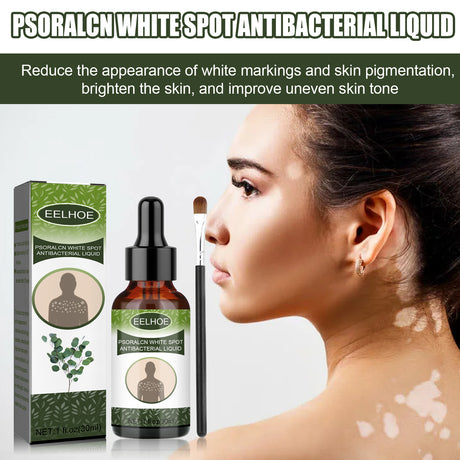 White Spot Purifying Serum For Whitening And Repairing White Spot Spot And Perspiration Spot Skin Moisturizing Serum - V.I.P Digital Presence