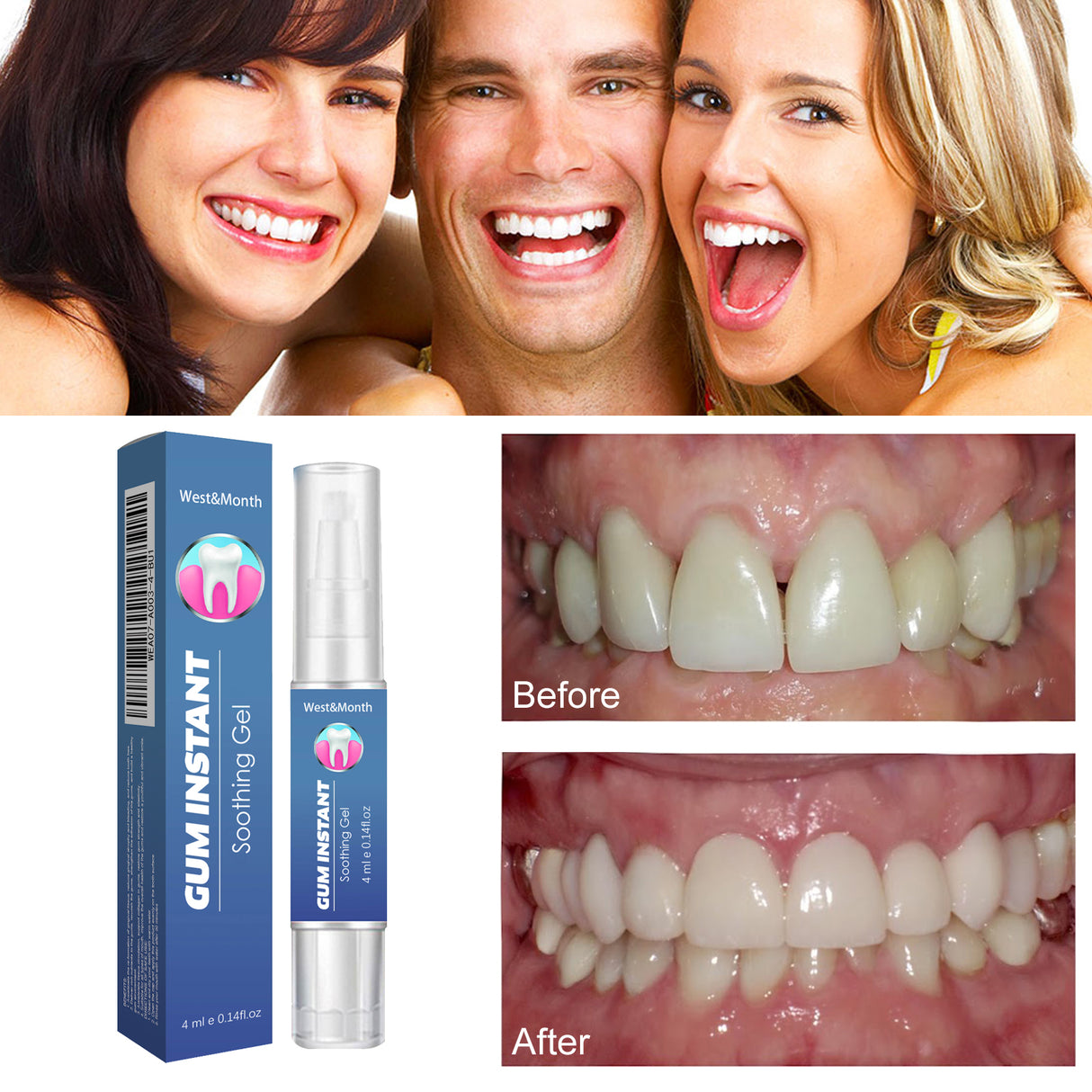 WestMonth Gum Instant Soothing Gel, Relieve Gums Swelling And Pain Clean Teeth Plaque Stains And Whiten Teeth Gel - V.I.P Digital Presence