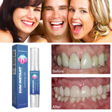 WestMonth Gum Instant Soothing Gel, Relieve Gums Swelling And Pain Clean Teeth Plaque Stains And Whiten Teeth Gel - V.I.P Digital Presence
