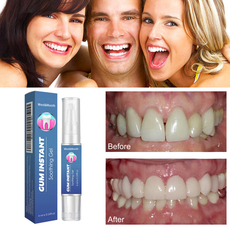 WestMonth Gum Instant Soothing Gel, Relieve Gums Swelling And Pain Clean Teeth Plaque Stains And Whiten Teeth Gel - V.I.P Digital Presence