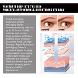 Strawberry Gel Patch Reduces Fine Lines Under Eyes, Bags Under Eyes, Dark Circles, Firming Eyes, Anti-Wrinkle Moisturizing Eye Patch