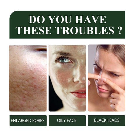 Green Tea Blackhead Removal Mask Deeply Cleanses Skin, Tightens Pores And Lightens Blackheads - V.I.P Digital Presence