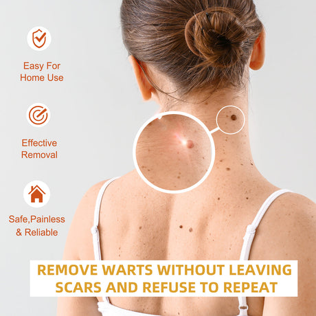 Anti-wart Essence, Anti Warts Fade Moles Corns Smoothing Skin Care Essence - V.I.P Digital Presence