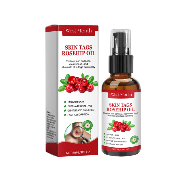 Rosehip Seed And Wart Essence Oil, Moisturizes And Restores Smooth Skin - V.I.P Digital Presence