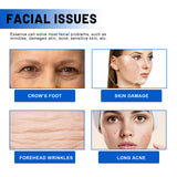 Blueberry Facial, Care Facial Skin Deep Cleansing Anti-Wrinkle Skin Care Essence Beauty Brightening Cream - V.I.P Digital Presence