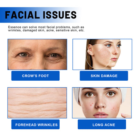 Blueberry Facial, Care Facial Skin Deep Cleansing Anti-Wrinkle Skin Care Essence Beauty Brightening Cream - V.I.P Digital Presence