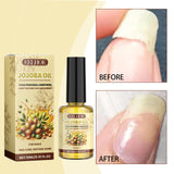 Jojoba Oil For Nails, Nail Care Anti-Barb Edge Oil Softening Nourishing Base Oil For Nail Protectors - V.I.P Digital Presence