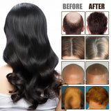 NMN Scalp Cell Revitalizing Hair Essence, Hair Care Strengthen And Strengthen Hair Repair Hair Root Thickening Hair Moisturizing Essence - V.I.P Digital Presence