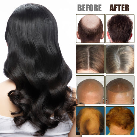 NMN Scalp Cell Revitalizing Hair Essence, Hair Care Strengthen And Strengthen Hair Repair Hair Root Thickening Hair Moisturizing Essence - V.I.P Digital Presence