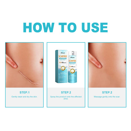 Scarfree Advanced Skin Spray, Body Skin Care Reduces Post-Natal Scars And Smooths Skin - V.I.P Digital Presence
