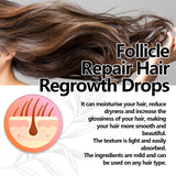 Follicle Repair Hair Regrowth Drops, Hair Protection Strong And Solid Hair Thickening Scalp Nourishing Massage Lotion - V.I.P Digital Presence