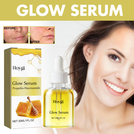Glow Serum, Moisturizing And Whitening Skin To Reduce Facial Spots And Fine Lines - V.I.P Digital Presence
