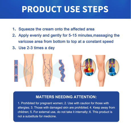 Vein Massage Varicose Cream Repair Earthworm Legs To Relieve Leg Blood Vessel Bulge And Varicoidea - V.I.P Digital Presence