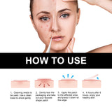 JAYSUING Cute Black Acne Patch, Facial Acne Lightening Repair Acne Closing Acne Mark Blackhead Removal