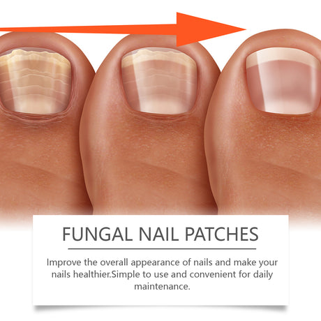 Nail Care Patches Gently Repair Nails For Easy Daily Cleaning With Simple Care Patches - V.I.P Digital Presence