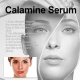 Calamine Serum, Improve Skin Dry Dull Acne Muscle Acne Hydrating Plump - V.I.P Digital Presence