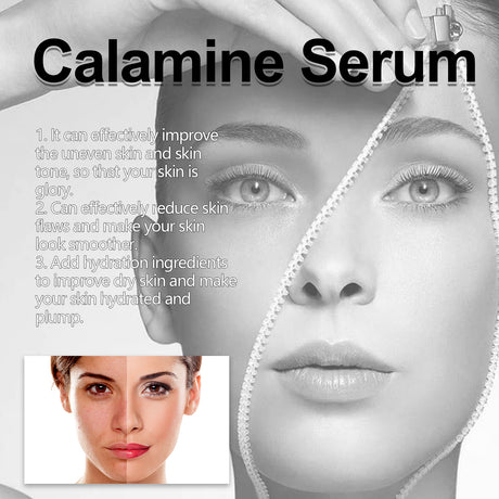Calamine Serum, Improve Skin Dry Dull Acne Muscle Acne Hydrating Plump - V.I.P Digital Presence