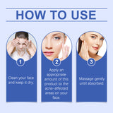 Herbal Acne-Clearing Cream Face Refreshing Oil Control Gentle Pore Cleansing Cream