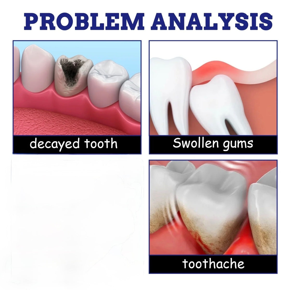 PainFree Oral Relief Spray