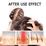 King Of Ginger, Hair Root Nourishing And Thickening Hair Strong Anti-Scalp Massage Treatment Capsule - V.I.P Digital Presence