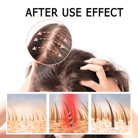 King Of Ginger, Hair Root Nourishing And Thickening Hair Strong Anti-Scalp Massage Treatment Capsule - V.I.P Digital Presence