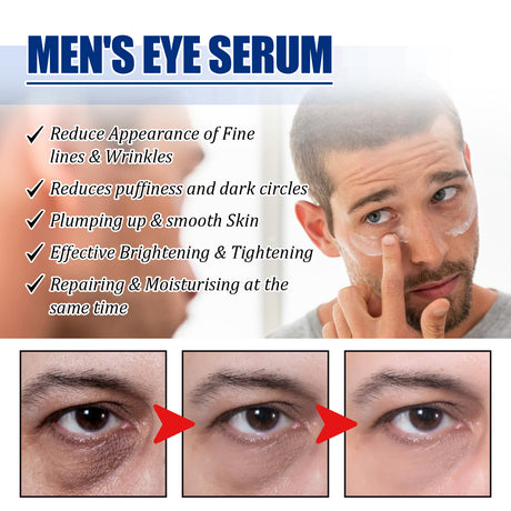 Rejuvenate Eyes Peptide Lifting Eye Gel, Hydrating Moisture Lock Moisture Repair Dull Anti-Aging Eye Care Cream - V.I.P Digital Presence