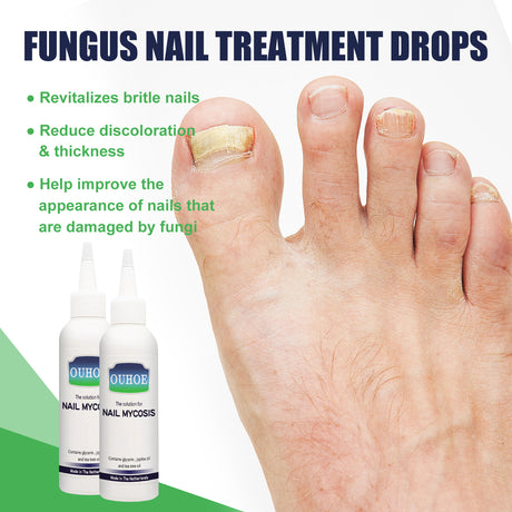 Gray Nail Repair Drops, Repair Hand And Foot Gray Nails Soft And Bright Nail Thickening Nail Care Solution - V.I.P Digital Presence