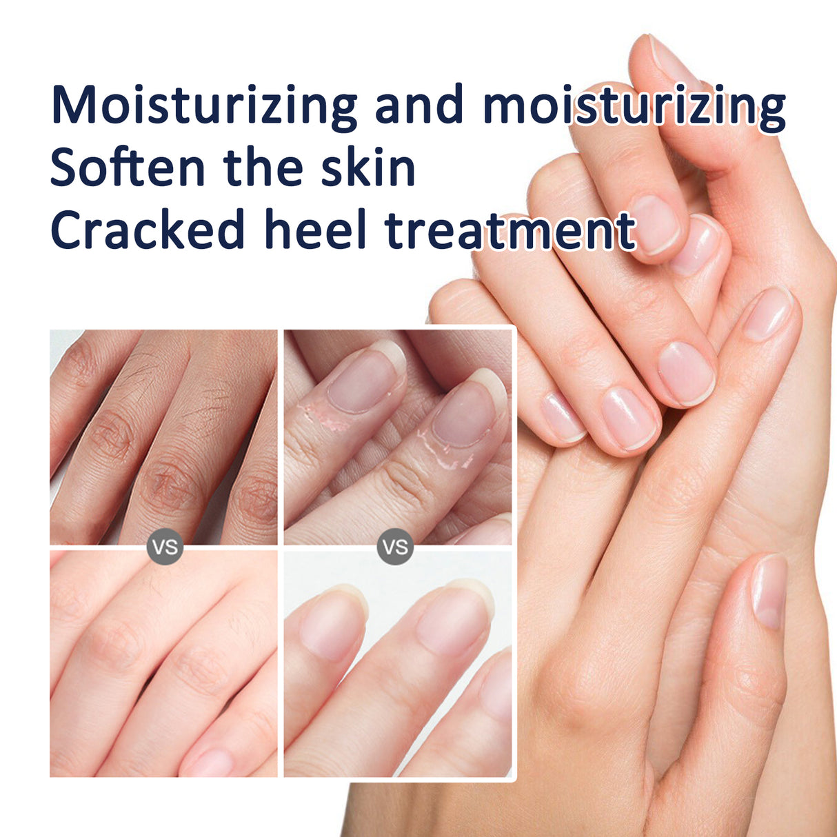 Anti-Crack Repair Hand Cream, Improves Cracked Rough Skin, Removes Dead Skin And Hydrates Hands And Feet Cream
