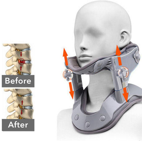 Cervical support cervical spine traction device hot compress physiotherapy cervical spine adjustable support correction cervical spine fixator - V.I.P Digital Presence