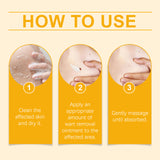 Keyu Care Cream, Gently Clean, Moisturize, Dilute Meat Granules, Repair And Smooth Skin Care Cream - V.I.P Digital Presence