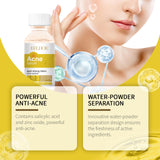 Face Essence Improve Acne Muscle Acne Closing Gentle Cleansing Face Skin Face Essence - V.I.P Digital Presence