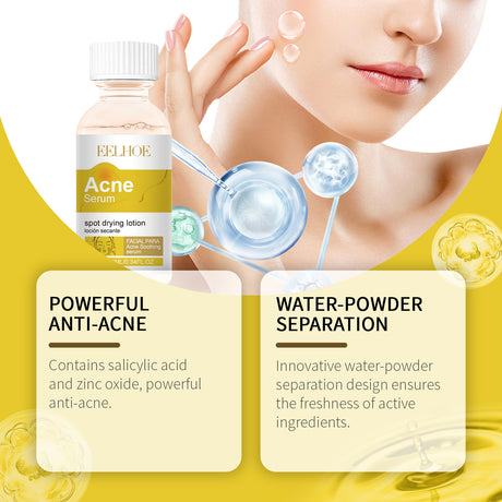 Face Essence Improve Acne Muscle Acne Closing Gentle Cleansing Face Skin Face Essence - V.I.P Digital Presence