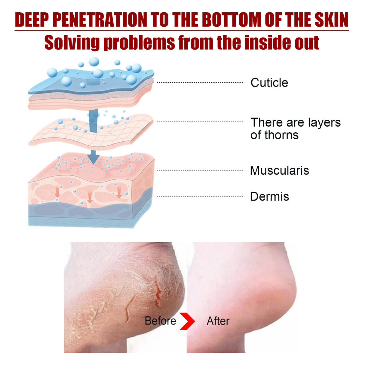 Exfolating Foot Mask, Tender Skin To Moist Calluses To Exfoliate Dead Skin Hydrating Foot Care - V.I.P Digital Presence