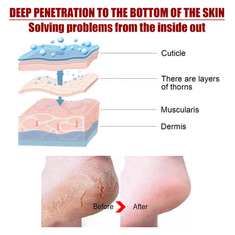 Exfolating Foot Mask, Tender Skin To Moist Calluses To Exfoliate Dead Skin Hydrating Foot Care - V.I.P Digital Presence