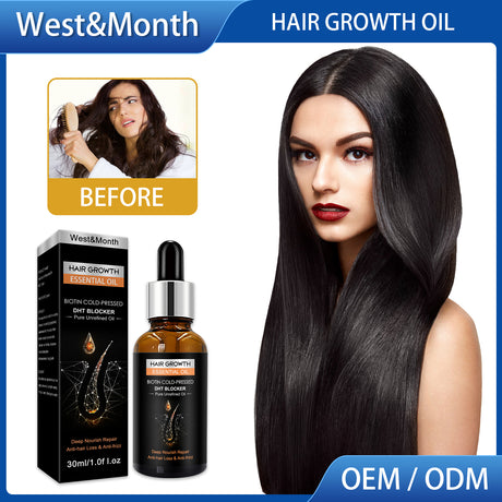 Hair Growth Essential Oil, Dense Hair Growth Repair Dry Hair And Moisture Hair Essence - V.I.P Digital Presence