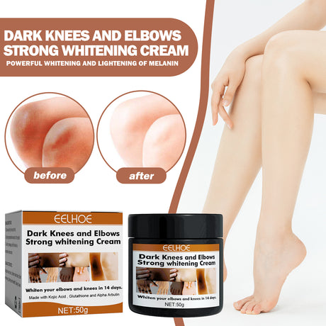 Joint Whitening Cream, Moisturizes Dull Skin Whitening Repair Cream For Joints And Elbows - V.I.P Digital Presence