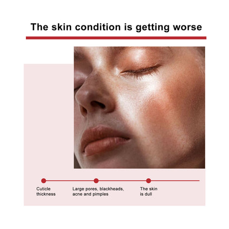 Mandelic Acid Daily Update Essence, Acne-Removing And Acne-Closing Repair Brightening Fruit Acid Essence - V.I.P Digital Presence