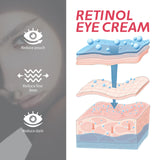 Retinol Eye Cream, Eye Skin Moisturizing Treatment Fade Fine Lines Dark Circles Elastic Firming Eye Cream - V.I.P Digital Presence