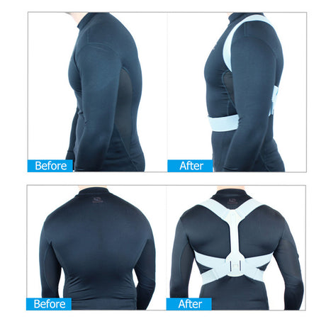 Humpback Correction Belt Student Adult Back Spine Corrector Posture Corrector - V.I.P Digital Presence