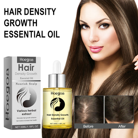 Hair Density Growth Essential Oil, Nourishing Hair Root Repair Perming Dry Damaged Hair Supple Hair Care Essential Oil - V.I.P Digital Presence