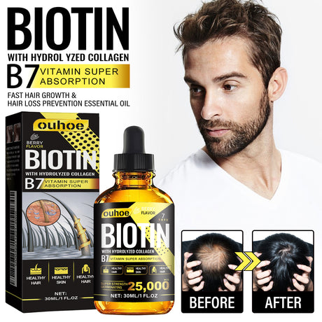 Collagen B7 Vitamin Hair Care Essential Oil Nourishes Hair Gently And Softens Hair - V.I.P Digital Presence