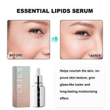 Essentical Lipids Serum, The Face Tightens The Fine Lines Of The Eyes Of The Law Wrinkles The Skin Anti-Wrinkle And Anti-Aging - V.I.P Digital Presence